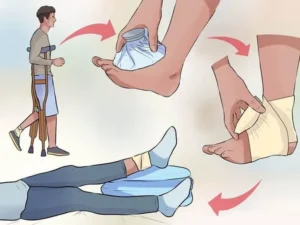 Lật Sơ Mi Cổ Chân: Xử Lý Hiệu Quả Cùng Keovip.online